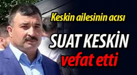 SUAT KESKİN VEFAT ETTİ